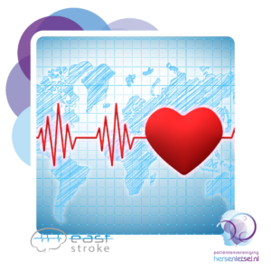 De East stroke studie